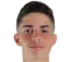 Pedrinho